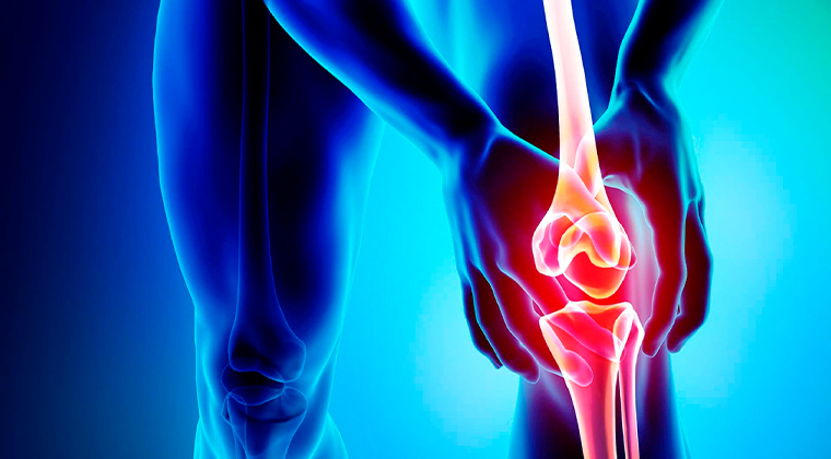 Imagen de Artrosis (Desgaste Articular)