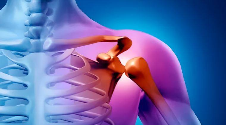 Imagen de Luxaciones